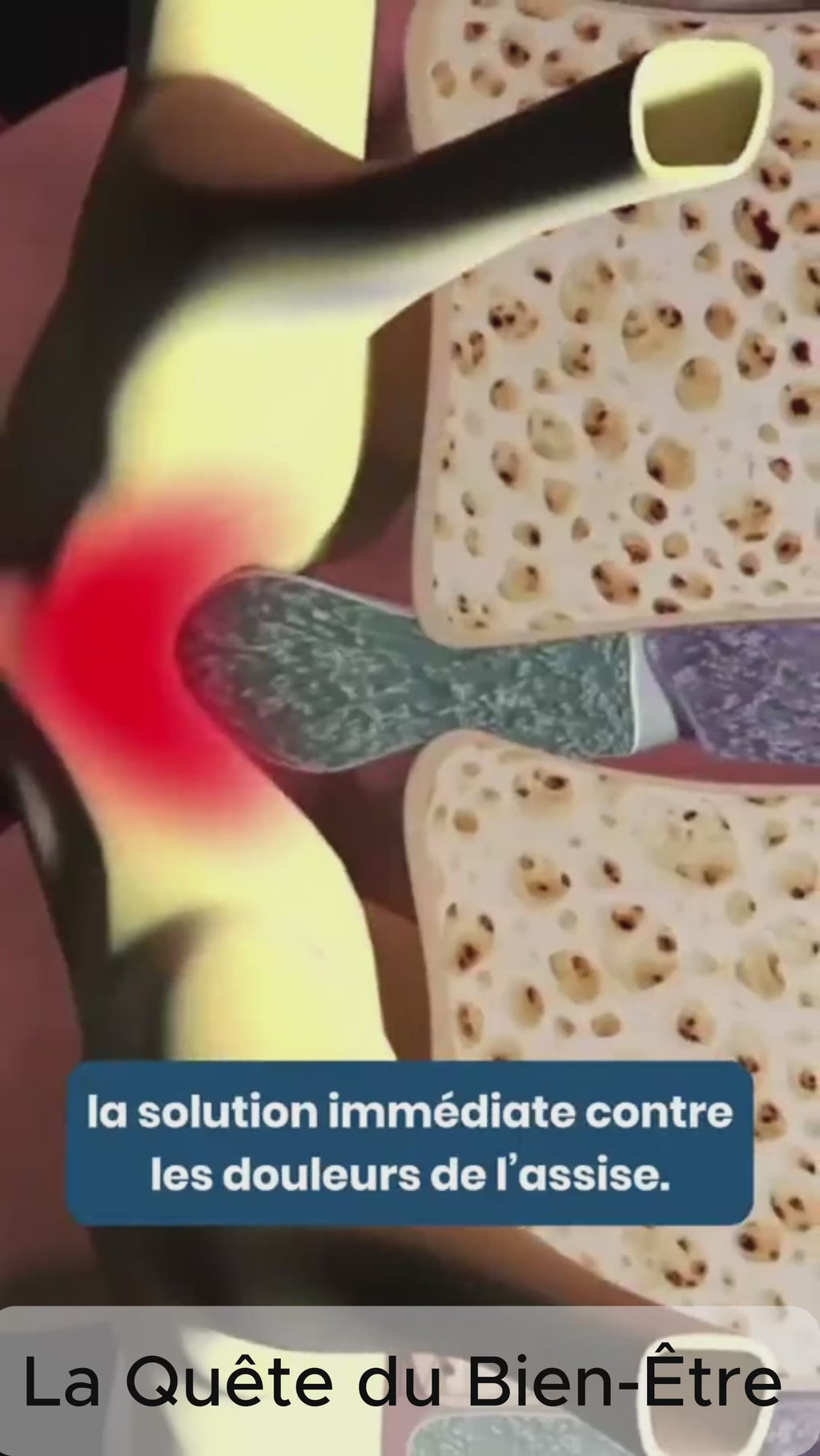Coussin de siège en gel ergonomique – Soulage le dos, le coccyx et les hanches