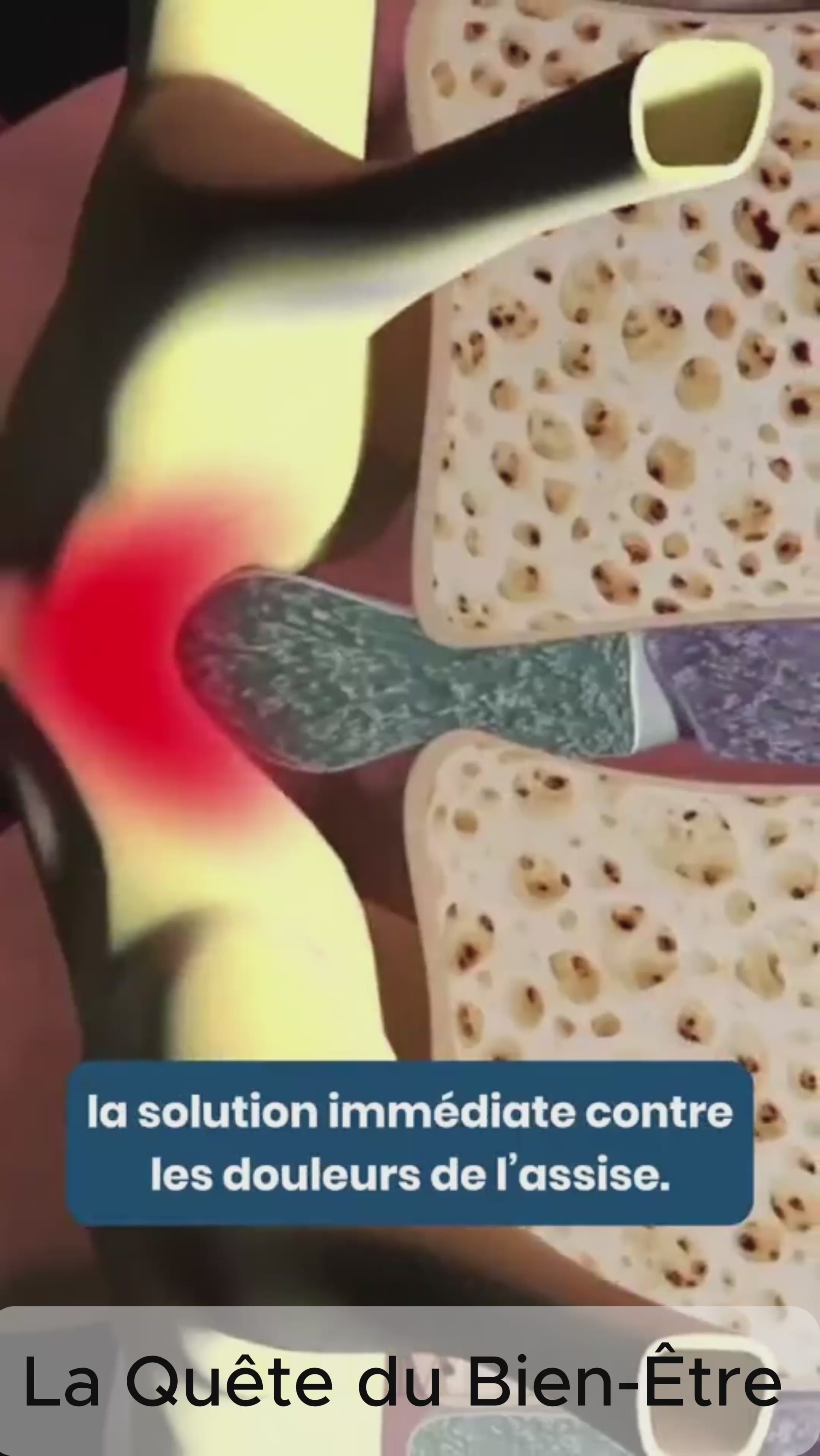 Coussin de siège en gel ergonomique – Soulage le dos, le coccyx et les hanches